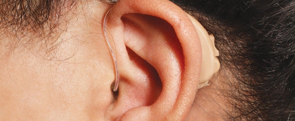 Close-up of a person's ear wearing a beige Lucid Hearing aid with a clear tube leading into the ear canal. The image clearly showcases the traditional behind-the-ear hearing aid design and its secure fit.