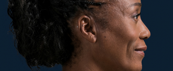 Close-up side profile of a woman smiling slightly, with a discreet hearing aid tucked behind her ear against a dark blue background. The image highlights the subtle design of hearing aids, aligning with Miracle Ear's focus on modern hearing solutions.