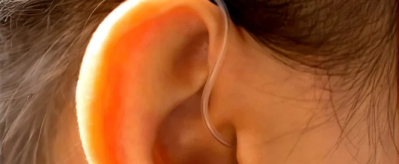 Close-up of a person's ear wearing a lightweight Otofonix hearing aid with a thin, clear tube curving into the ear canal. The image highlights the device's minimal and discreet design, blending naturally with the skin.